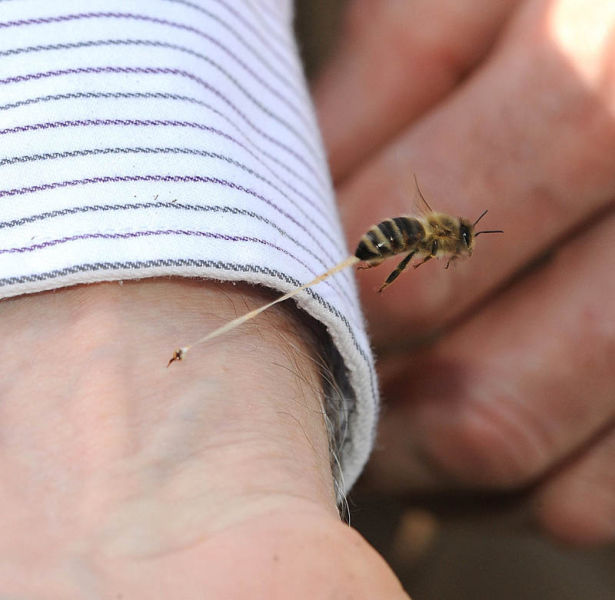 Image 3 -- The honeybee’s final sting